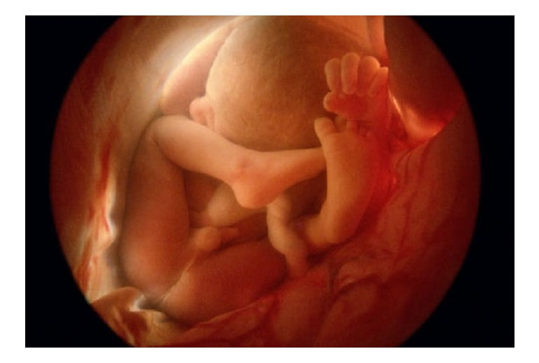 Abortion Unborn